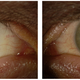 Image for article titled Ebola Turned This Man's Eye From Blue To Green